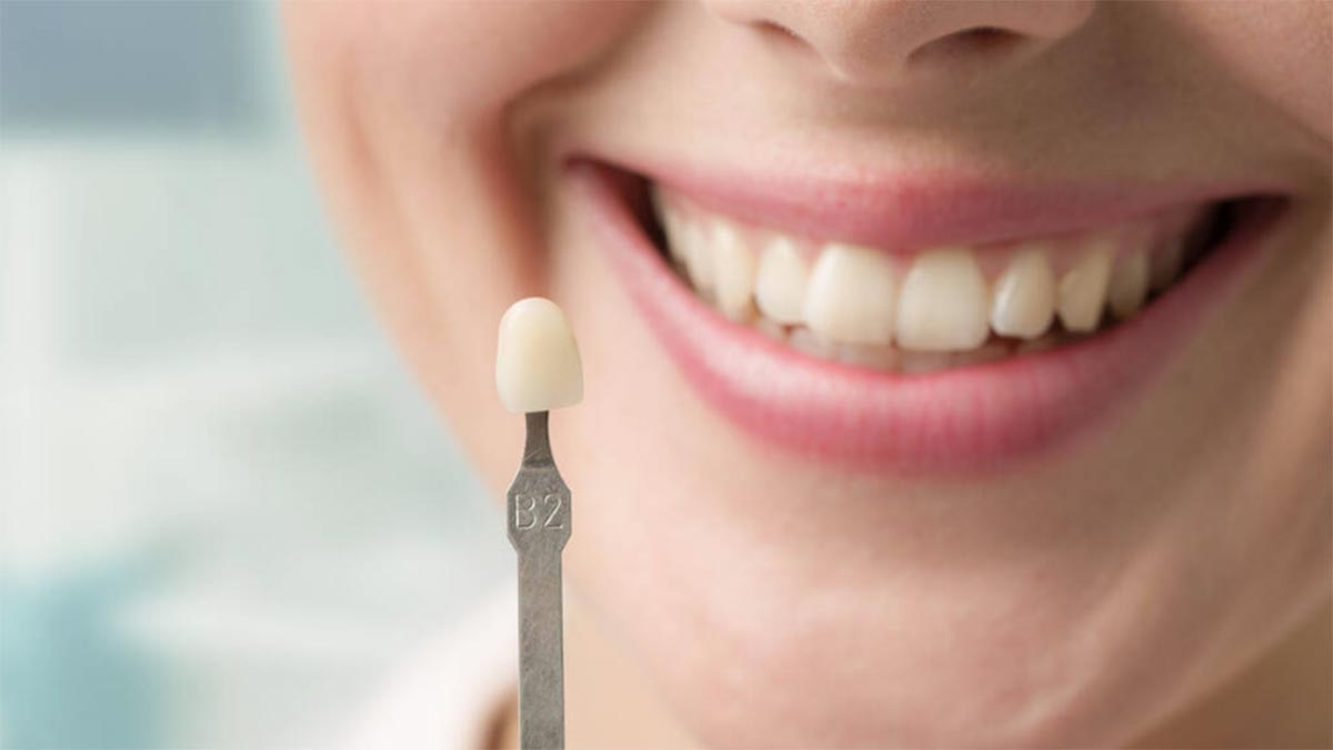 implant nasıl yapılır? implant nasıl yapılır?