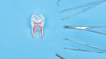 Kanal Tedavisi Yapılan Diş Çürür mü?