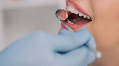 Kanal Tedavisi Yapılan Diş Çürürse Ne Olur?