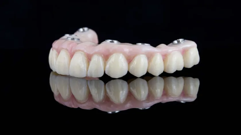 Damaksız Diş Protezi Nasıl Yapılır?