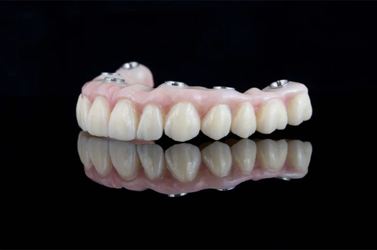 Damaksız Diş Protezi Nasıl Yapılır?