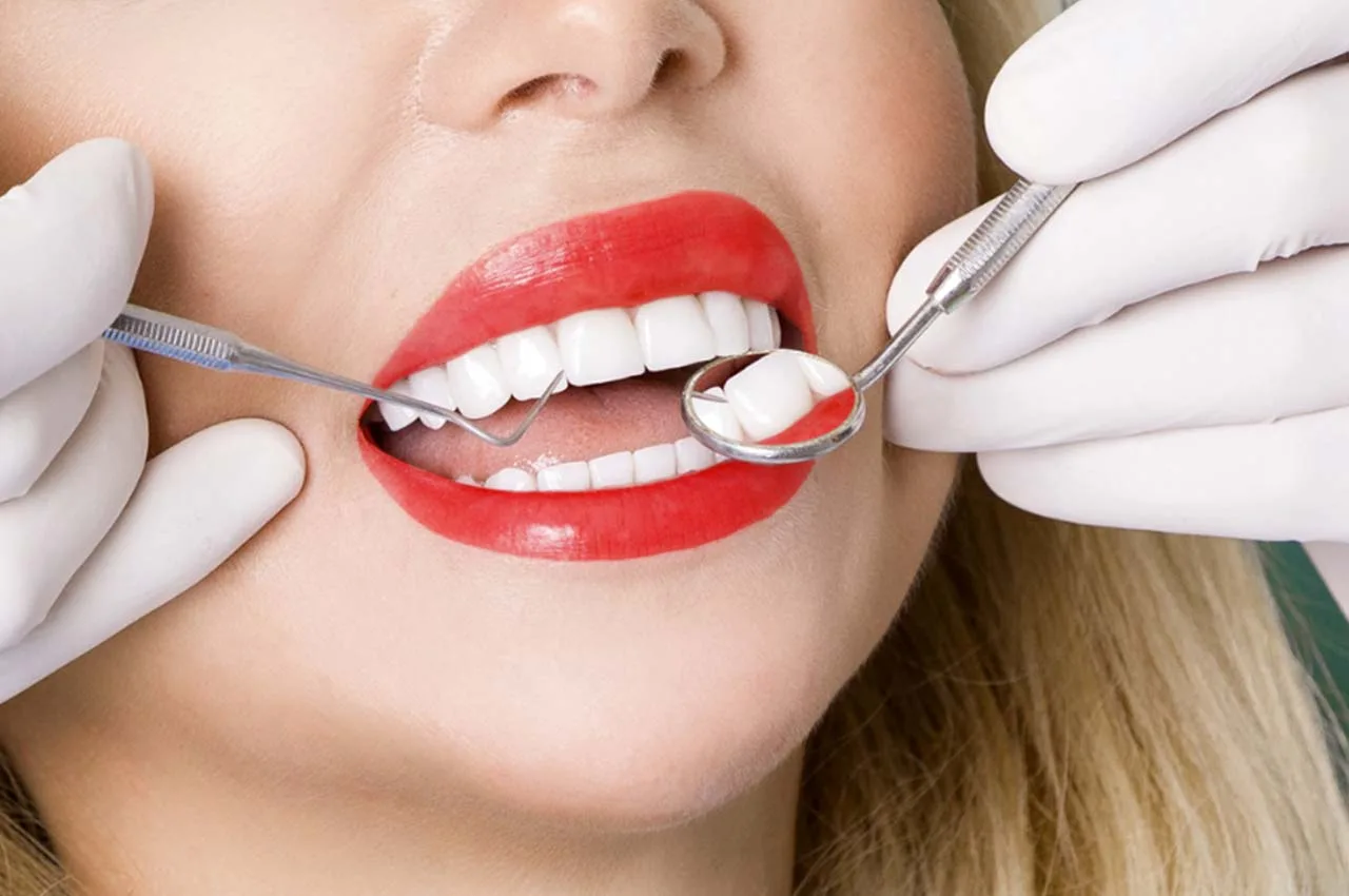 Porselen Dişin Altındaki Diş Çürürse! Ne Yapılır?